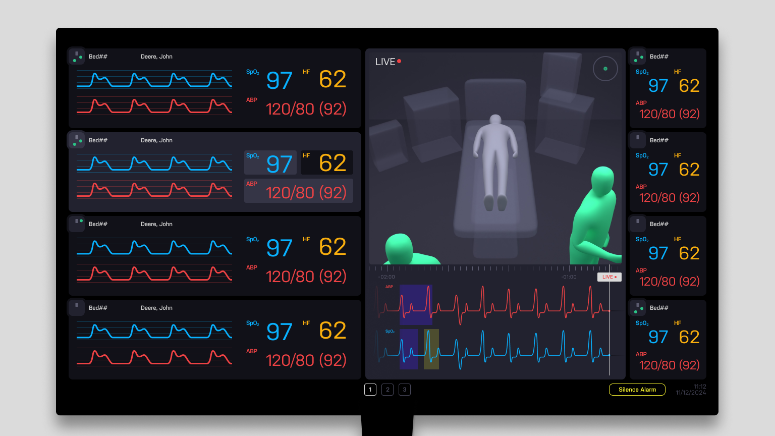 image of patient monitor